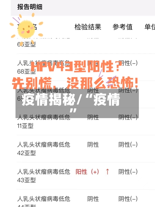 疫情揭秘/“疫情	”-第2张图片