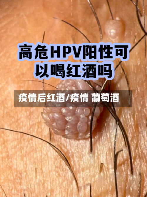 疫情后红酒/疫情 葡萄酒