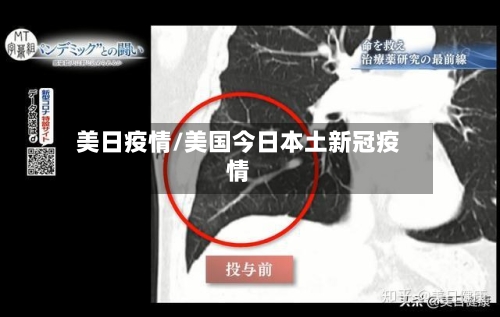 美日疫情/美国今日本土新冠疫情