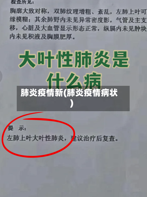肺炎疫情新(肺炎疫情病状)-第2张图片
