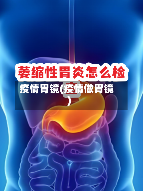 疫情胃镜(疫情做胃镜)