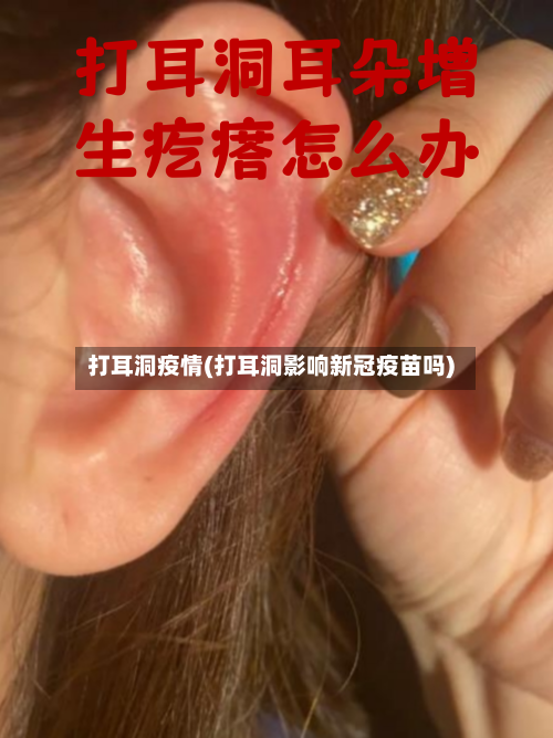 打耳洞疫情(打耳洞影响新冠疫苗吗)