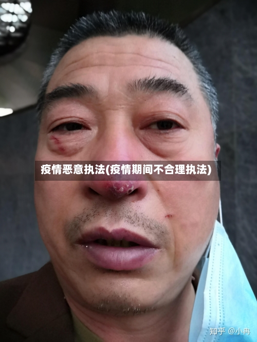 疫情恶意执法(疫情期间不合理执法)-第2张图片