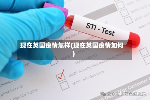 现在英国疫情怎样(现在英国疫情如何)-第3张图片