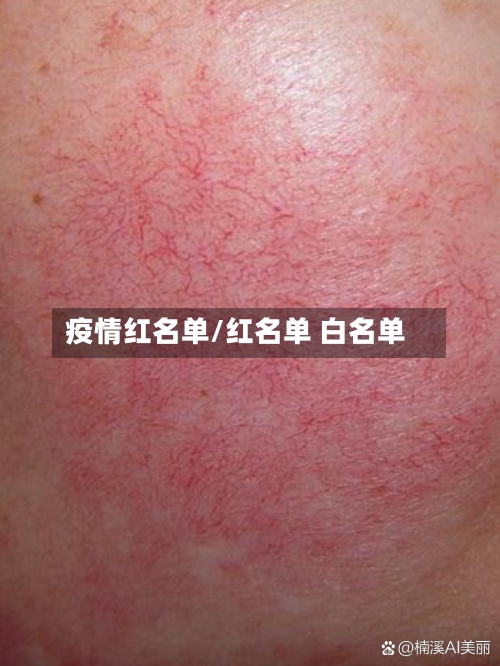 疫情红名单/红名单 白名单