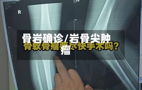 骨岩确诊/岩骨尖肿瘤-第3张图片