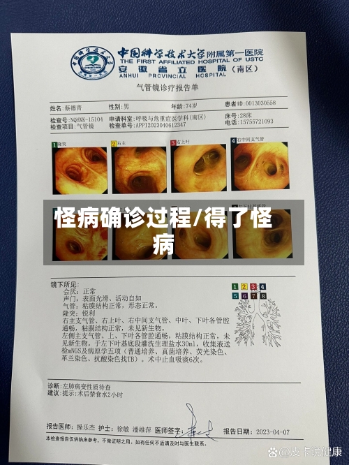 怪病确诊过程/得了怪病