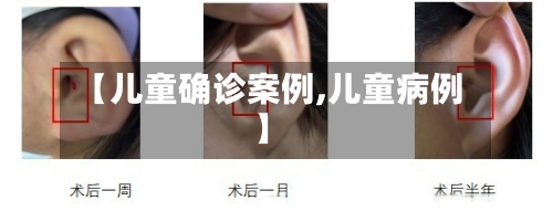【儿童确诊案例,儿童病例】